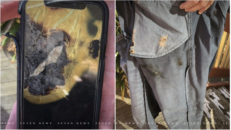 iPhone X взорвался в кармане пользователя и привел к ожогам ноги второй степени | Канобу - Изображение 1